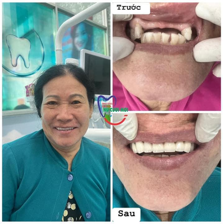 Top 3 phòng khám nha khoa đáng tin cậy nhất huyện Cái Bè, Tiền Giang