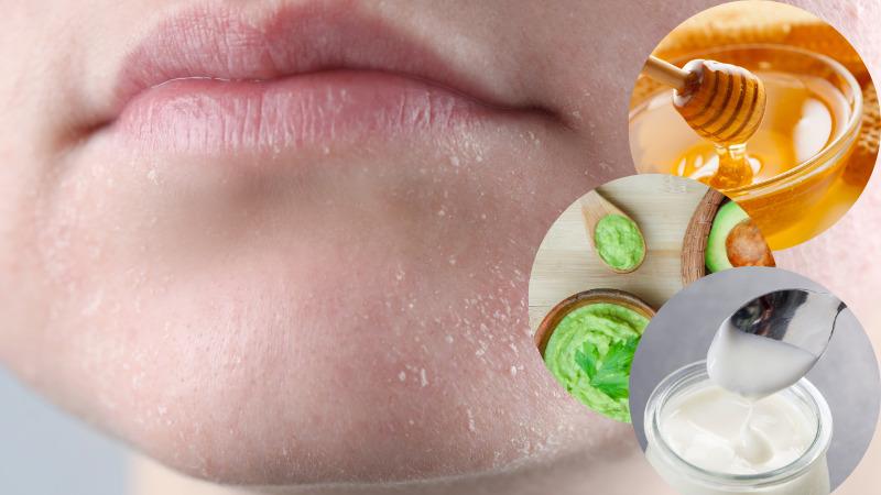 Phương pháp trị nứt nẻ da hiệu quả vào mùa đông