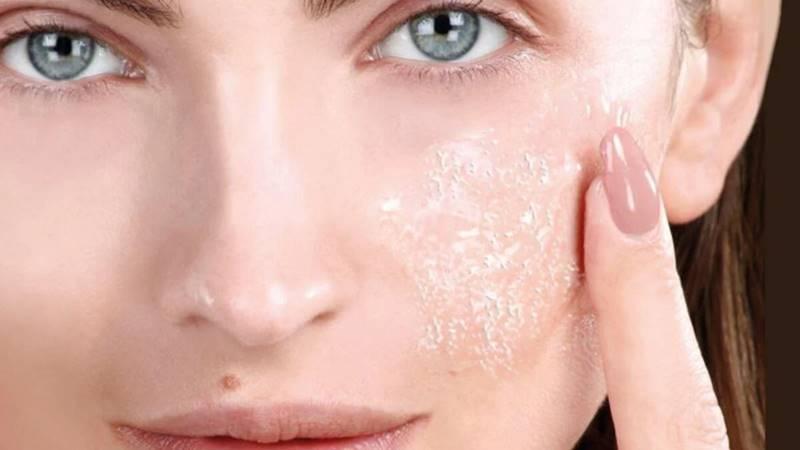 Peel da là gì? Liệu có nên áp dụng phương pháp Peel da không?