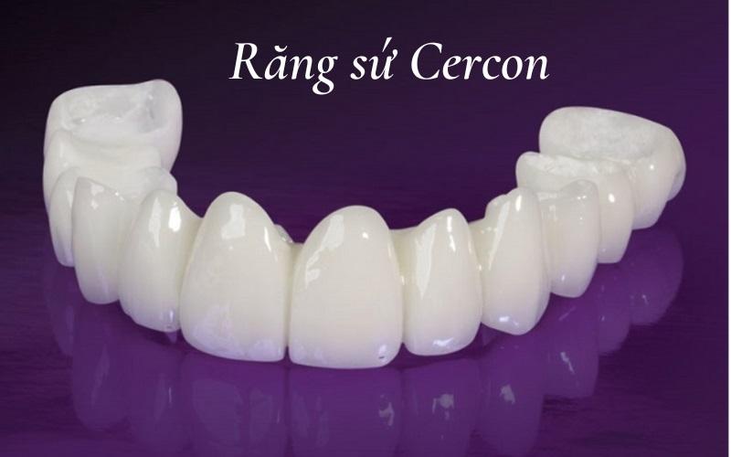 Răng sứ Cercon có đảm bảo chất lượng cao không? Giá thành hiện tại của loại răng sứ này là bao nhiêu?