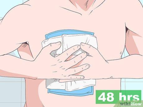 Phương pháp điều trị vết bầm tím xương sườn