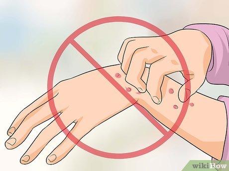 Phương pháp chữa ngứa bàn tay và bàn chân vào ban đêm