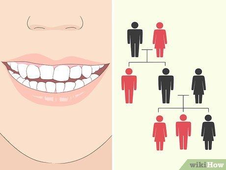 Cách khắc phục nụ cười lệch miệng hiệu quả