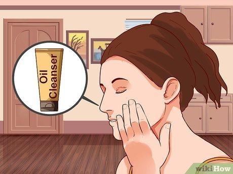 Cách điều trị bệnh Rosacea: Liệu các phương pháp tự nhiên có thực sự hiệu quả?