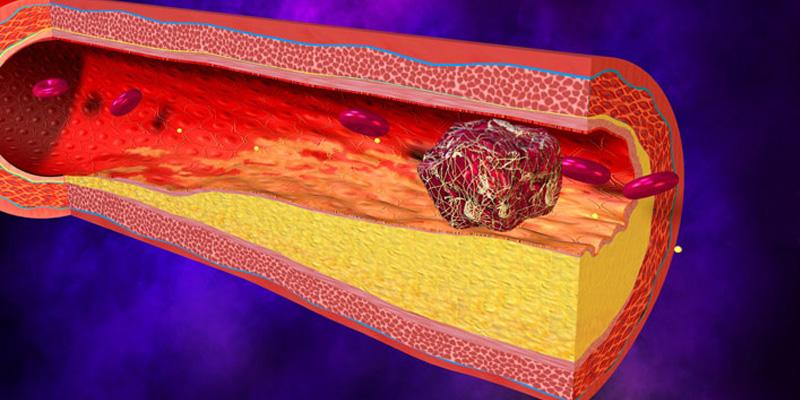 Vitamin K1 là gì và nó có tầm quan trọng như thế nào đối với sức khỏe của chúng ta?