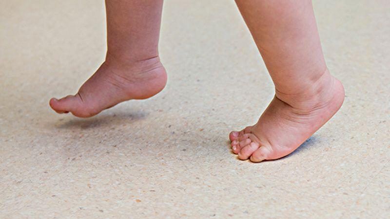 Các bác sĩ cảnh báo phụ huynh không nên lơ là khi thấy trẻ đi nhón chân.