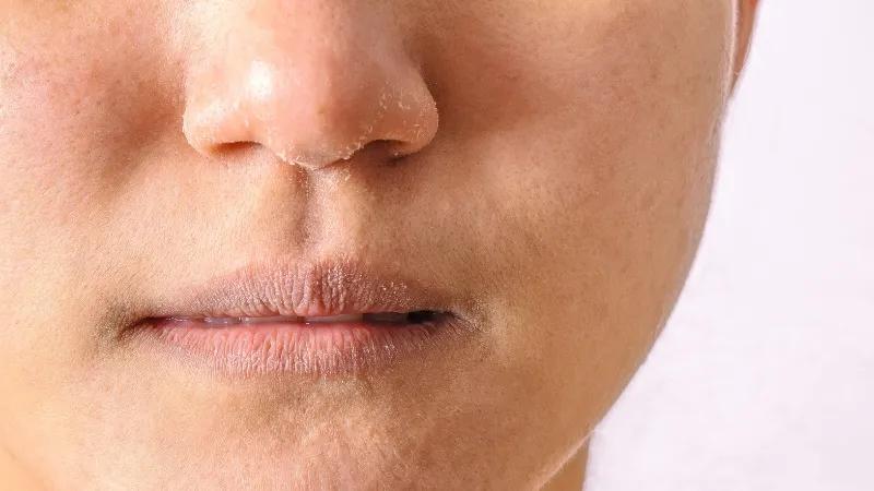 Top 5 thương hiệu phấn phủ mịn màng, hoàn hảo cho làn da khô, giúp bạn luôn tự tin với lớp trang điểm hoàn hảo.