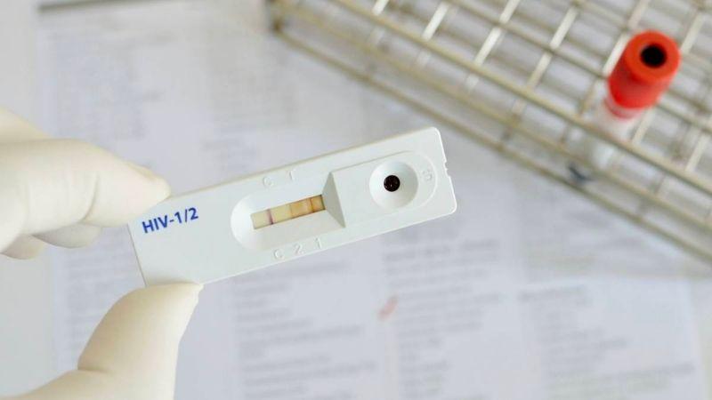 Hướng dẫn tự xét nghiệm HIV ngay tại nhà bằng que thử HIV, giúp bạn kiểm tra tình trạng sức khỏe một cách dễ dàng và thuận tiện.