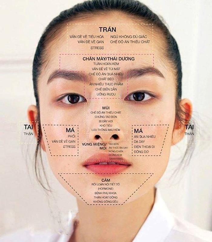 Vị trí của mụn có thể là dấu hiệu cho thấy tình trạng sức khỏe của bạn. Đừng bỏ qua những tín hiệu này, vì chúng có thể phản ánh những vấn đề bên trong cơ thể.