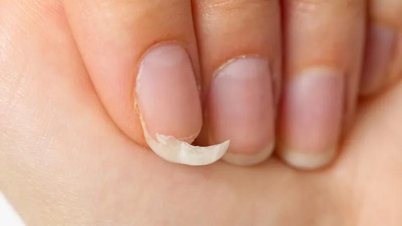Tại sao móng tay của bạn lại giòn và dễ gãy? Khám phá các bí quyết để giữ móng tay luôn khỏe mạnh và bền đẹp.