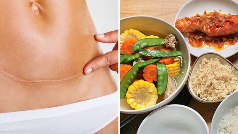 10 thực đơn dưỡng sinh cho mẹ sinh mổ giúp mẹ nhiều sữa và phục hồi sức khỏe nhanh chóng