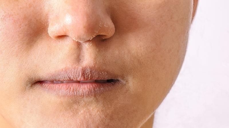 6 phương pháp chăm sóc da mặt chuẩn mùa đông, ngăn ngừa khô nẻ hiệu quả
