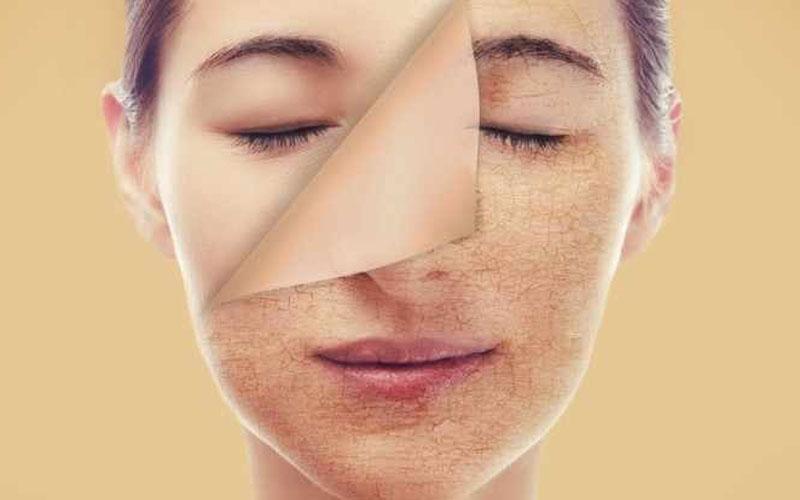 Tại sao bạn vẫn chăm sóc da hàng ngày mà làn da không trắng lên?