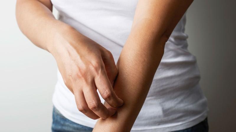 Vì sao lại xảy ra tình trạng dị ứng với nước biển? Làm thế nào để khắc phục khi gặp phải tình trạng này?