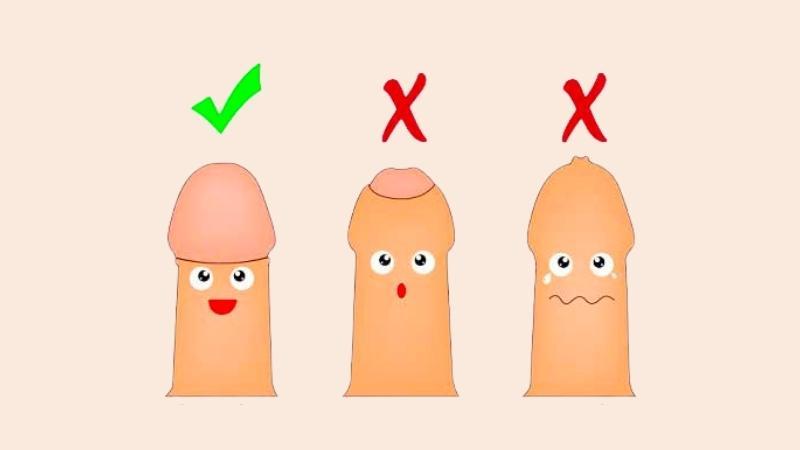 Lời khuyên từ bác sĩ: Ba mẹ có cần phải cắt bao quy đầu cho trẻ sơ sinh hay không?