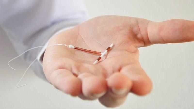 Khi nào là thời điểm lý tưởng để đặt vòng tránh thai sau khi sinh mổ?