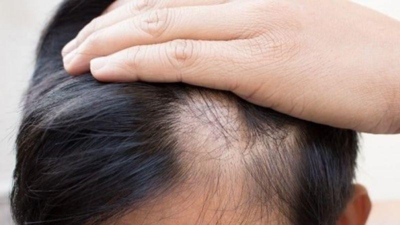 Khám phá 6 chai xịt dưỡng tóc cho nam giúp cấp ẩm, làm mềm tóc và dễ dàng tạo kiểu
