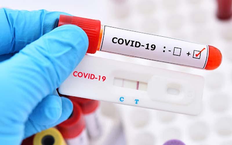 Kết quả test Covid có sự xuất hiện của vạch mờ và vạch đậm, liệu chúng có phản ánh tình trạng sức khỏe của bạn hay không?