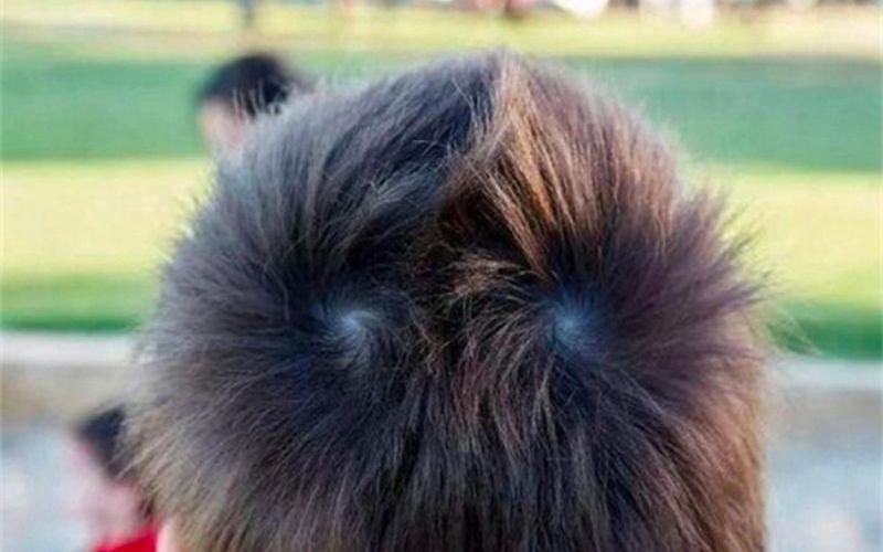 Liệu việc trẻ có hai xoáy tóc có phải là dấu hiệu của trí thông minh vượt trội? Hãy cùng khám phá sự thật về quan niệm này.