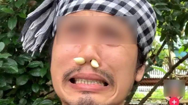 Phương pháp nhét tỏi vào mũi để trị xoang liệu có thực sự hiệu quả như lời đồn? Cùng tham khảo ý kiến từ các chuyên gia trong bài viết này.