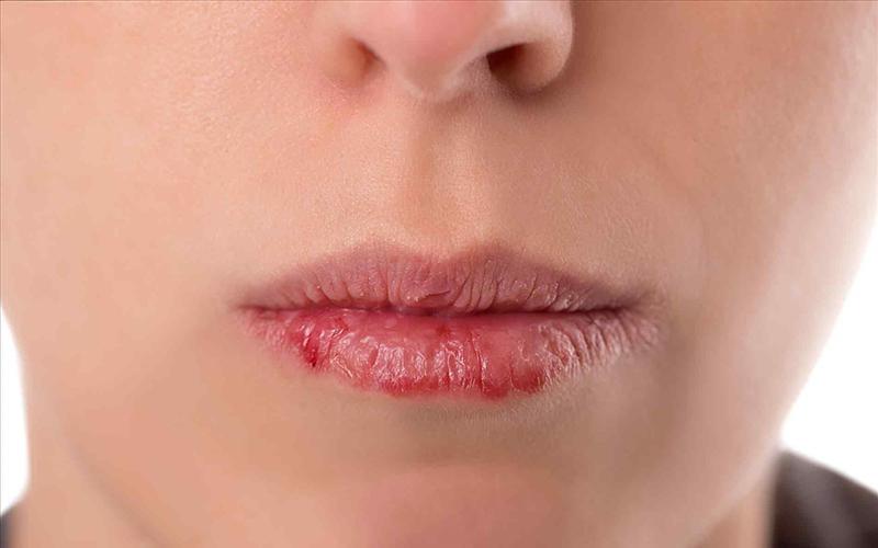 Làm sao để có một đôi môi hoàn hảo?