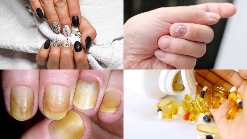 5 phương pháp hiệu quả giúp giữ cho móng tay luôn sáng bóng, mềm mại và hồng hào tự nhiên