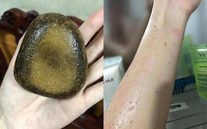 Sử dụng đá cuội để tẩy tế bào chết cho da có thực sự an toàn?