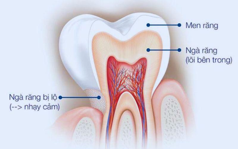 Liệu men răng có thể tự phục hồi? Khám phá 8 phương pháp giúp bảo vệ men răng và duy trì sức khỏe răng miệng.