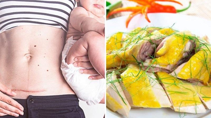 Sau khi sinh mổ, liệu phụ nữ có nên ăn thịt gà? Đây là câu hỏi mà nhiều bà mẹ mới sinh thắc mắc. Thịt gà có thật sự giúp phục hồi sức khỏe nhanh chóng và hiệu quả cho phụ nữ sau sinh mổ?