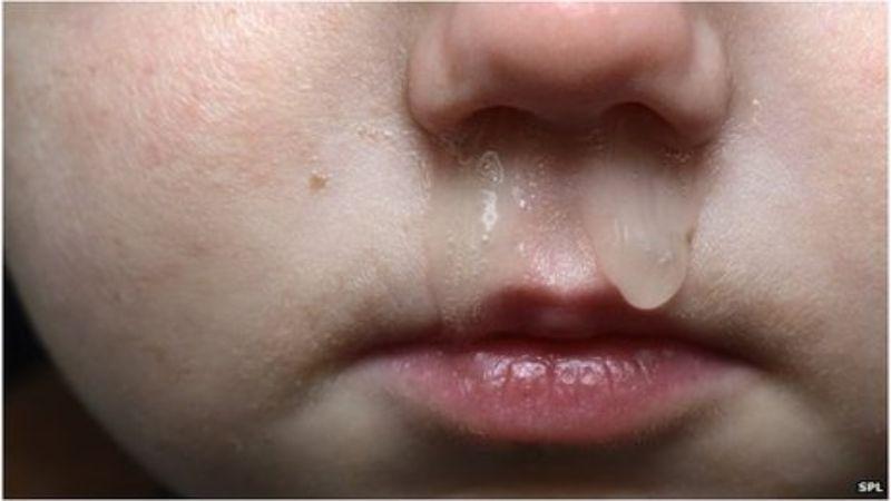 Màu sắc nước mũi có thể mang đến những thông điệp quan trọng về tình trạng sức khỏe của bạn. Những biến đổi này đôi khi là dấu hiệu cảnh báo các vấn đề cần chú ý, giúp bạn hiểu rõ hơn về cơ thể mình.