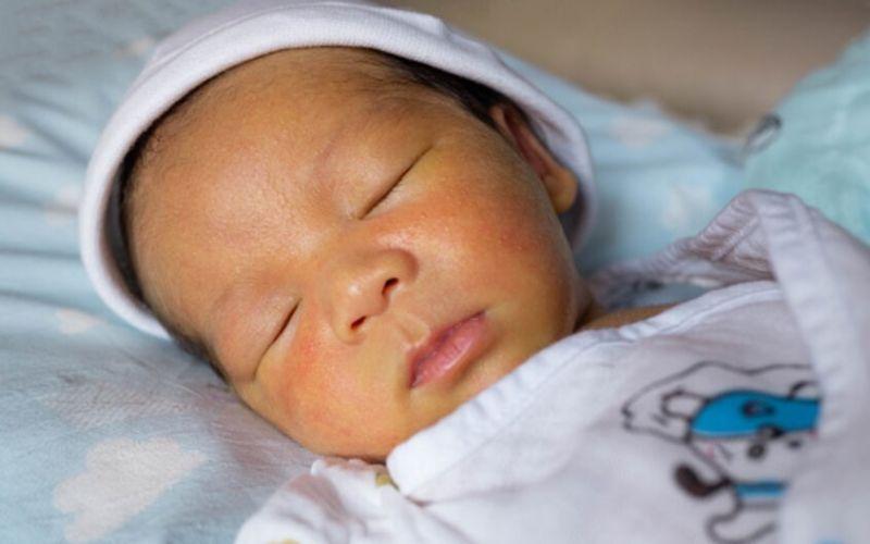 Vì sao trẻ sinh ra từ mẹ nhóm máu O lại dễ bị vàng da?