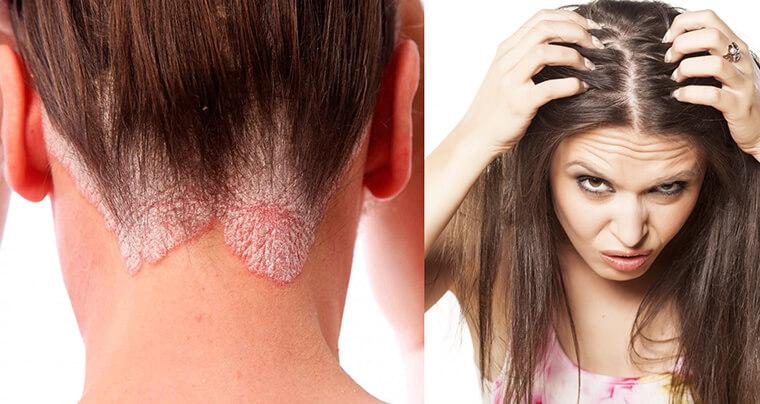 Làm sao để phân biệt dầu gội thật và giả?