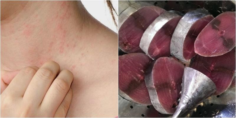 Những ai không nên ăn cá ngừ?
