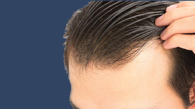 Hướng dẫn gội đầu và chăm sóc tóc cho nam giới