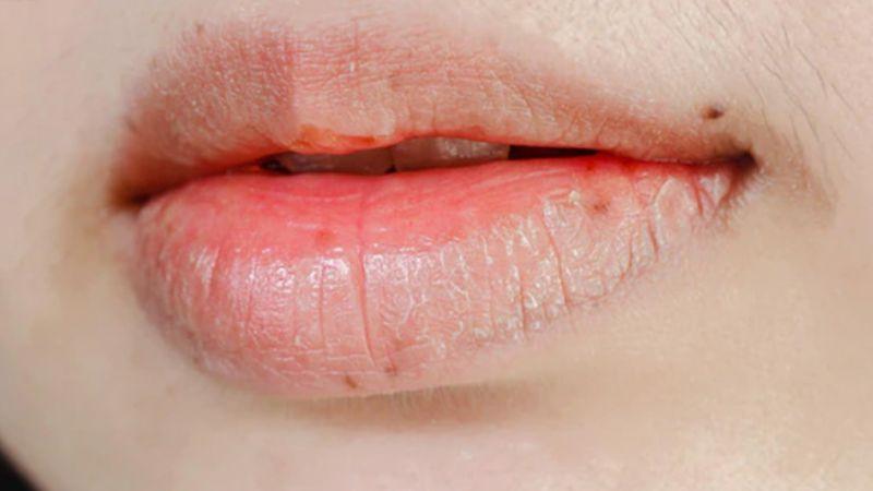 Một số lưu ý để trang điểm môi căng mọng và khắc phục khuyết điểm hiệu quả.