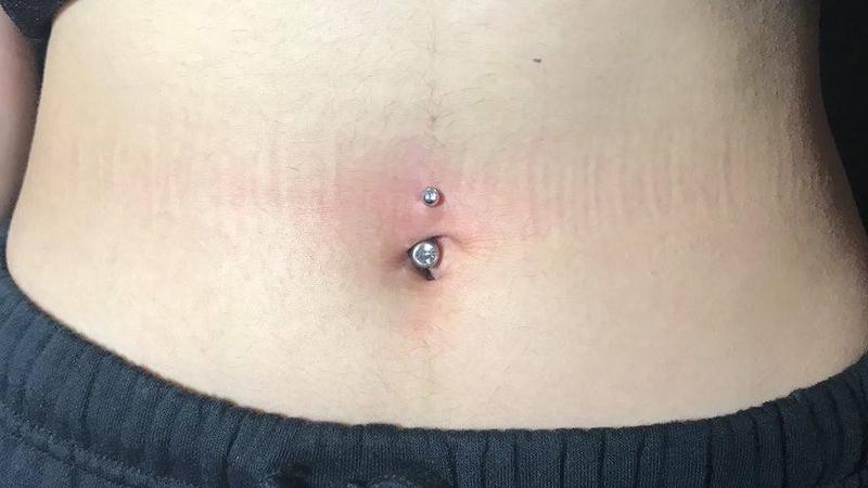 Xỏ khuyên rốn có gây đau đớn không? Những cách chăm sóc sau khi thực hiện xỏ khuyên rốn như thế nào?
