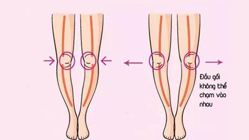 Khám phá 6 bài tập Yoga hiệu quả giúp cải thiện chân vòng kiềng, mang lại vóc dáng cân đối và tự tin hơn.