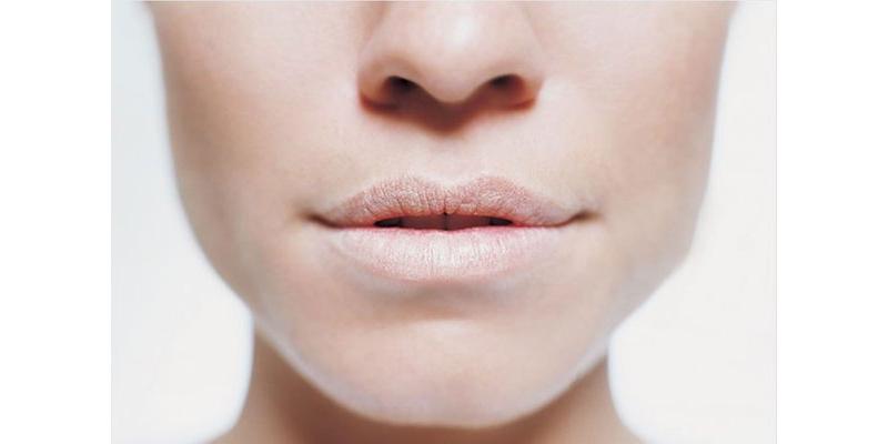 Khám phá sức khoẻ qua màu sắc của môi để nhận diện tình trạng cơ thể bạn