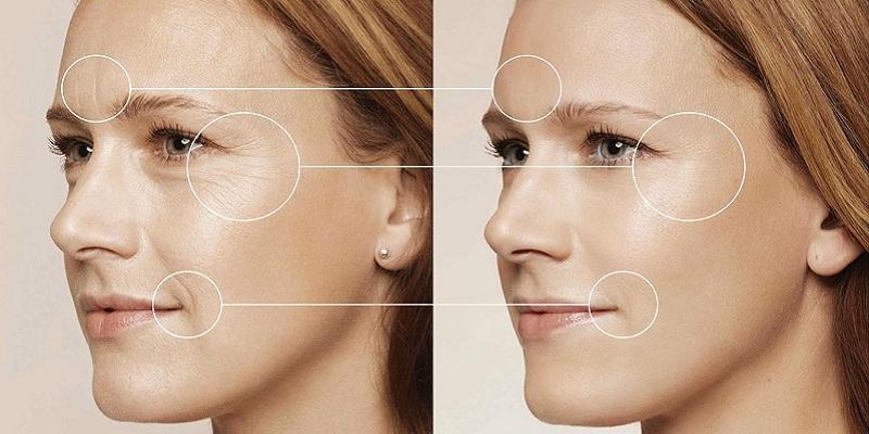 Lợi ích của bột sắn dây đối với làn da