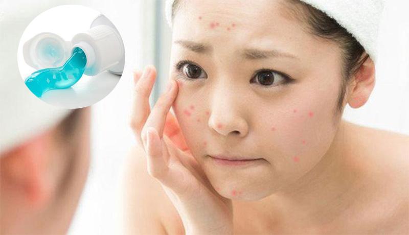Phương pháp rửa mặt bằng kem đánh răng giúp bảo vệ làn da của bạn