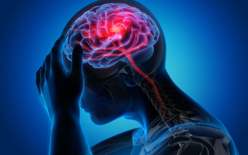 Cách giảm nhức đầu nhanh và hiệu quả ngay tại nhà