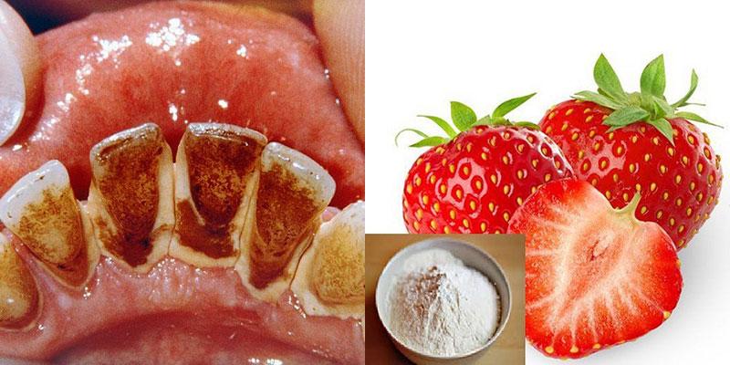 Mẹo nhanh chóng loại bỏ mảng bám răng tại nhà