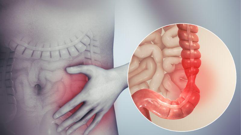 Tại sao uống cà phê lại gây cảm giác đau bụng và đi ngoài?
