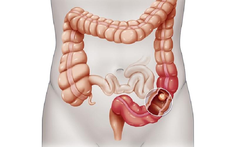 6 Công dụng tuyệt vời của bắp ngô