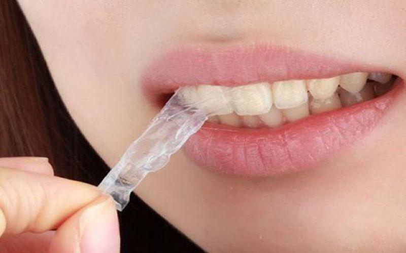 Sử dụng miếng dán trắng răng: Liệu có thực sự hiệu quả?