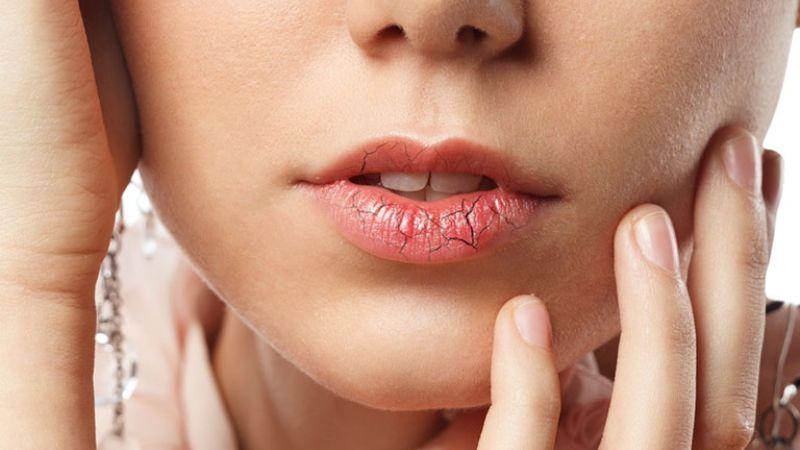 Dị ứng son môi: Nguyên nhân, biểu hiện và cách xử lý hiệu quả