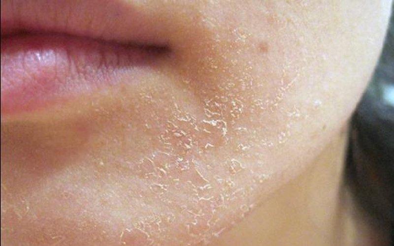6 bước chăm sóc da khô luôn mịn màng và rạng rỡ tại nhà