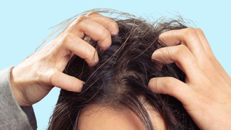 Những thói quen này có thể khiến da đầu bạn dễ xuất hiện mùi hôi khó chịu.