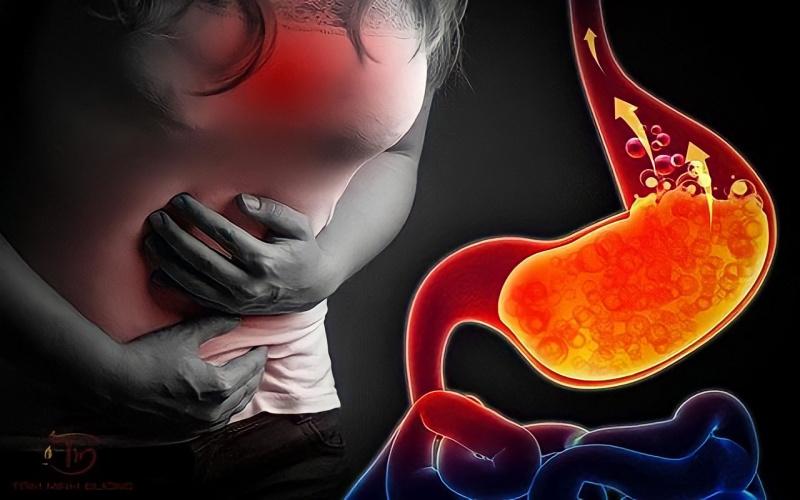 Khám phá 12 phương pháp chữa trị trào ngược dạ dày thực quản hiệu quả và an toàn tại nhà