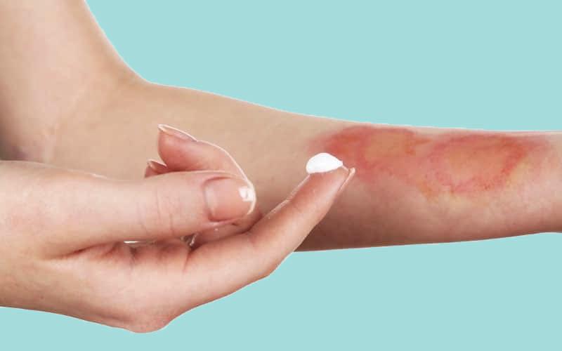 Panthenol (Tiền vitamin B5) là gì? Những tác dụng thần kỳ đối với làn da của bạn